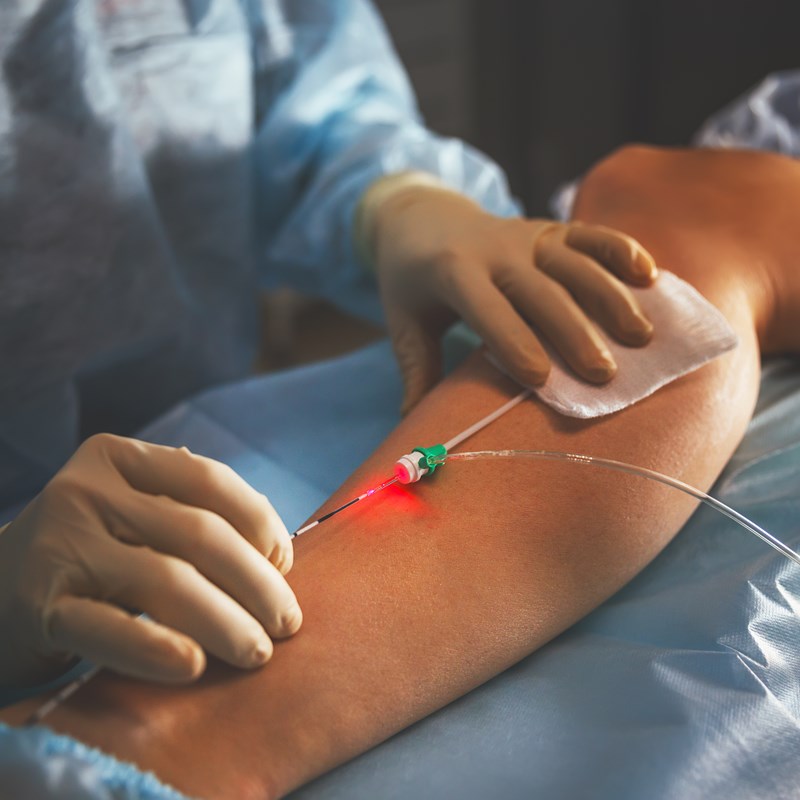 Gefäßchirurgie